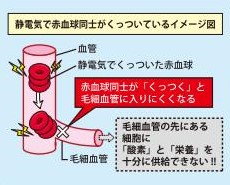 静電気について